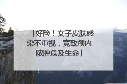 好险！女子皮肤感染不重视，竟致颅内脓肿危及生命